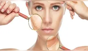 Peruanos están expuestos a mayores niveles de radiación ultravioleta en este verano