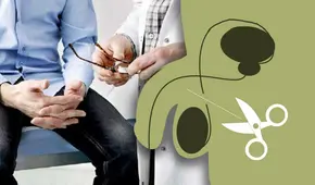 Campaña de vasectomía gratis en Perú: ¿dónde puedo realizarme el procedimiento?