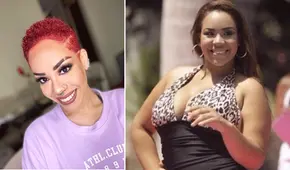 ¿Qué fue de Mirella Paz tras bajar 36 kilos a causa de la cirugía de manga gástrica?