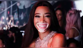 Winnie Harlow: la primera Modelo con vitíligo elegida por Victoria’s Secret