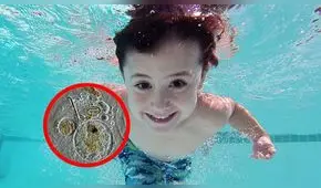 Todo lo que debes saber de la ameba ‘come cerebro’