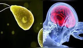 Ameba “come cerebros”: ¿qué es y cómo debemos cuidarnos de este parásito?