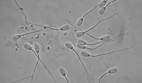 ¿Por qué la cantidad y la calidad de los espermatozoides está disminuyendo en el mundo?