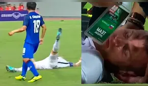 YouTube: Así salvaron la vida de jugador tras recibir un pelotazo [VIDEO]