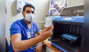 INSN San Borja utiliza impresión 3D para cirugías complejas en niños