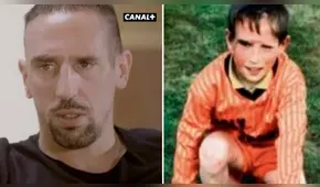 Frank Ribery sobre su cicatriz: "La gente siempre miraba mi rostro, sufrí"