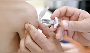 ¿Cómo distinguir entre el sarampión y la varicela?: Conoce las cinco diferencias