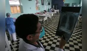 Personas entre 30 y 59 años lideran cifras de infectados por tuberculosis en Lambayeque
