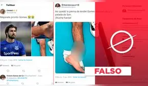 Fotos de un “tobillo destrozado” no corresponden a la fractura de André Gomes