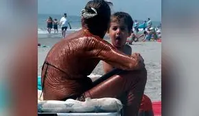 Círculo Dermatológico del Perú recomienda a la población proteger la piel del sol