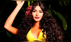 Miss Venezuela expuesta en redes con fotos antes de sus cirugías [FOTOS]