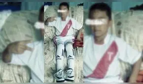 Tumbes: niño requiere de costosa operación para volver a caminar 