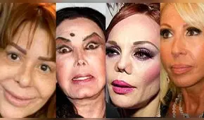 Alejandra Guzmán y otras estrellas que deformaron su rostro por abuso de cirugías  