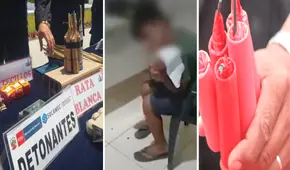 “No quiero quemarme”: menor de 14 años quedó con mano mutilada tras reventar rata blanca en Navidad