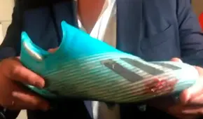 El estado del botín de Anderson Santamaría tras la lesión ocasionada por Yerry Mina [VIDEO]