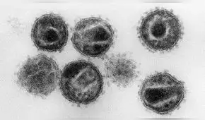 ¿Cómo ómicron pudo originarse en un paciente con VIH? ¿Cómo ómicron pudo originarse en un paciente con VIH?