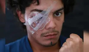 Chile: los ojos de la protesta