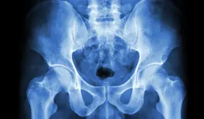 Por qué los humanos no heredaron la cola de sus ancestros