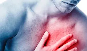 Más de 4.000 personas mayores de 40 años mueren cada año por infartos cardíacos en el Perú