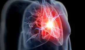 COVID-19: personas con enfermedades cardiovasculares tienen tres veces más riesgo de morir