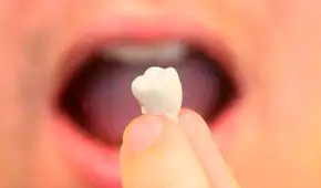 ¿Qué significa soñar que se te caen los dientes?, ¿será un mal presagio?
