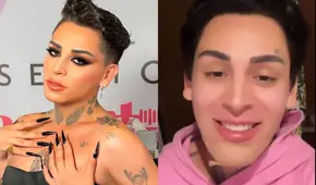 Kunno reveló que no puede sonreír por cirugía estética a la que se sometió recientemente