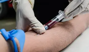 Detectan una nueva variante del VIH más contagiosa y agresiva