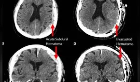 Confirman que la vida puede ‘pasar ante los ojos’ cuando estamos por morir