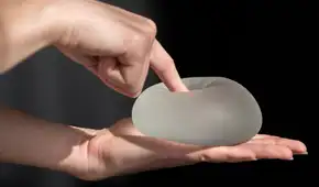 Implantes mamarios: ¿por qué se pueden romper y qué tan peligroso es? Implantes mamarios: ¿por qué se pueden romper y qué tan peligroso es?