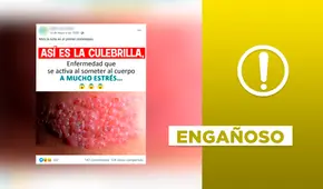 Es engañoso afirmar que la enfermedad denominada “culebrilla” se activa por cuadros de estrés