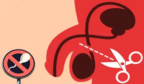 Vasectomía sin bisturí en el Perú: libérate de los mitos de este método anticonceptivo efectivo y seguro