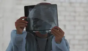 Detección de la tuberculosis en Perú retrocedió por impacto del COVID-19        