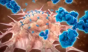 El fármaco que ha eliminado el cáncer de colon en todos los pacientes de un ensayo clínico El fármaco que ha eliminado el cáncer de colon en todos los pacientes de un ensayo clínico