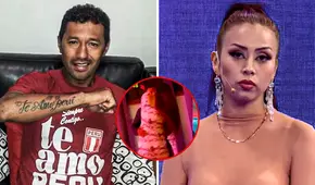 ¿Qué versiones manejan ‘Chorri’ Palacios y Ruth Medina sobre el ampay que protagonizaron?