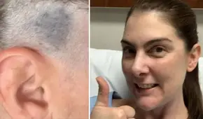 Fue a cortarse el cabello y su estilista notó algo que le salvó la vida: “Realmente me asustó”