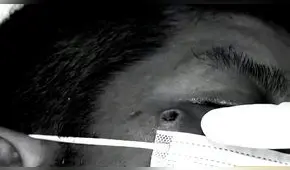 “Me dio fiebre, vi unos granitos y salí positivo”, testimonio de un paciente con viruela del mono