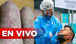Viruela del mono y COVID-19 EN VIVO: paciente con monkeypox en Piura tuvo contacto con 15 personas