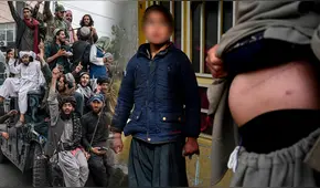 Pobreza dispara la venta de órganos en Afganistán a un año de la vuelta de los talibanes