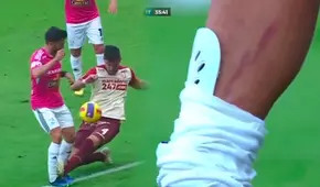 ¿Y la roja? La dura entrada de Alonso contra Sosa que le dejó la pierna marcada