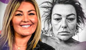 ¿Qué pasó con Amaia Montero para que sus seguidores se alarmen por su estado de salud?