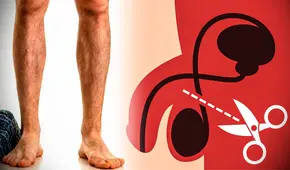 ¿Qué es la vasectomía y por qué cada vez más hombres jóvenes recurren a este método en EE. UU.?