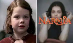 Actriz de “Las crónicas de Narnia” casi muere por bacteria come carne y expone sus secuelas Actriz de “Las crónicas de Narnia” casi muere por bacteria come carne y expone sus secuelas