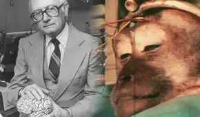 El experimento más cruel del doctor Robert White: trasplantó la cabeza de un mono a otro cuerpo