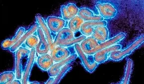 Guinea Ecuatorial declara alerta sanitaria tras confirmar 9 fallecidos por el virus de Marburgo