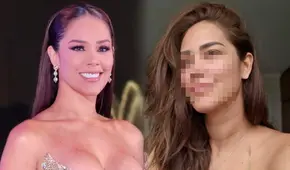 Karen Schwarz revela la enfermedad que padece en su piel a causa del estrés