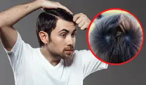 ¿Qué significa tener 1 o 2 remolinos en la cabeza y por qué aparecen?