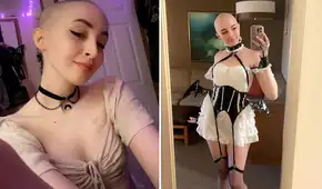 OnlyFans: joven usa ganancias para tratarse contra el cáncer y dice que sus fans "aman su look calvo" OnlyFans: joven usa ganancias para tratarse contra el cáncer y dice que sus fans "aman su look calvo"