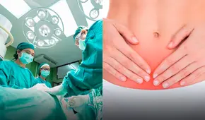 Extraen dildo de cristal de la vejiga de una mujer: se habría equivocado de orificio