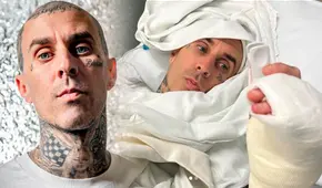 Travis Barker de Blink-182 tras cirugía en su dedo: "Fue un éxito, seguiré haciendo lo que me gusta"