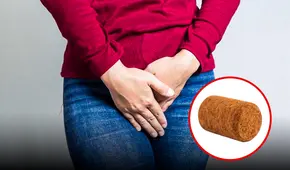 Extraen un corcho de la vagina de una mujer tras fallido juego sexual: lo tuvo durante 3 años